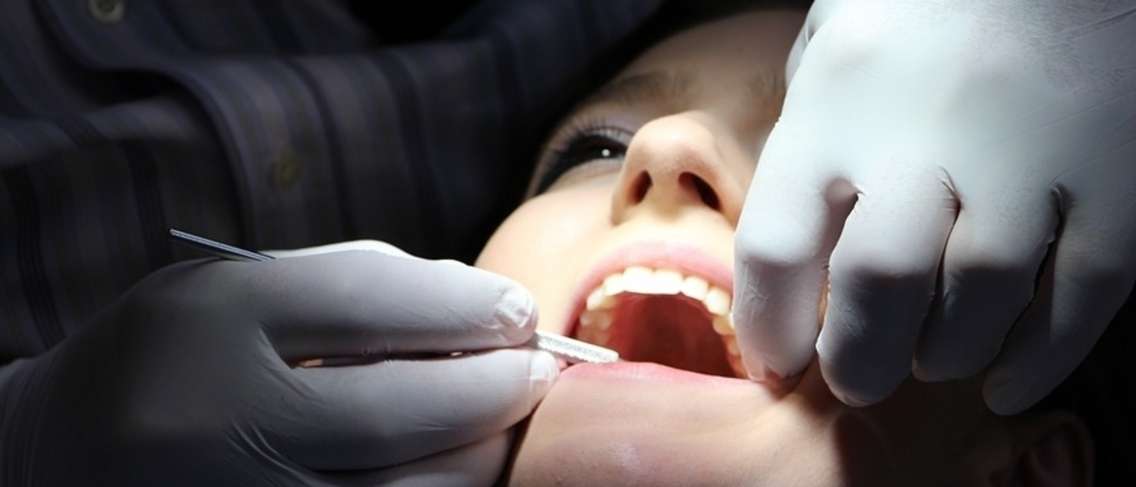 Zainteresirani ste za isprobavanje zubnih ljuskica? Prije svega saznajte utjecaj na zdravlje!