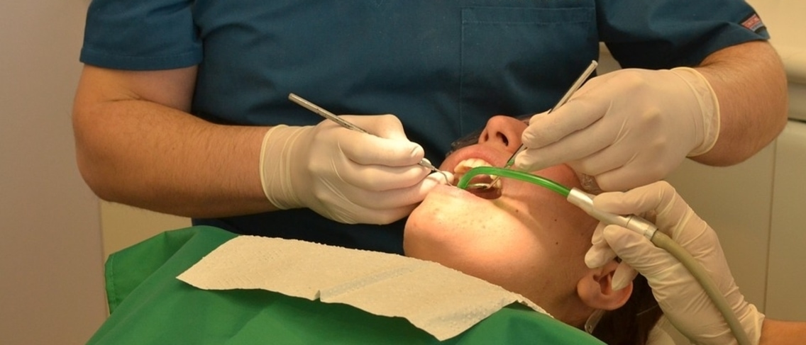 ¿Por qué necesita un tratamiento de conducto radicular antes de llenar los dientes?