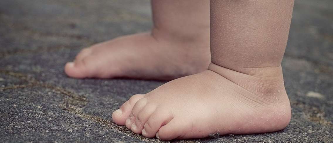 Los pies de los niños tienen forma O o X, ¿puede volver a ser normal?
