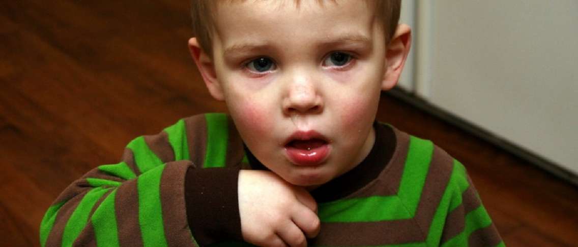 La tos infantil no se cura, ¿cuál es la cura?