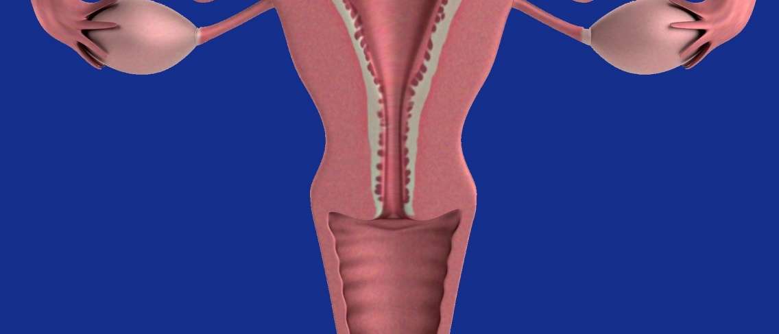 자궁 근종의 증상, 원인 및 치료