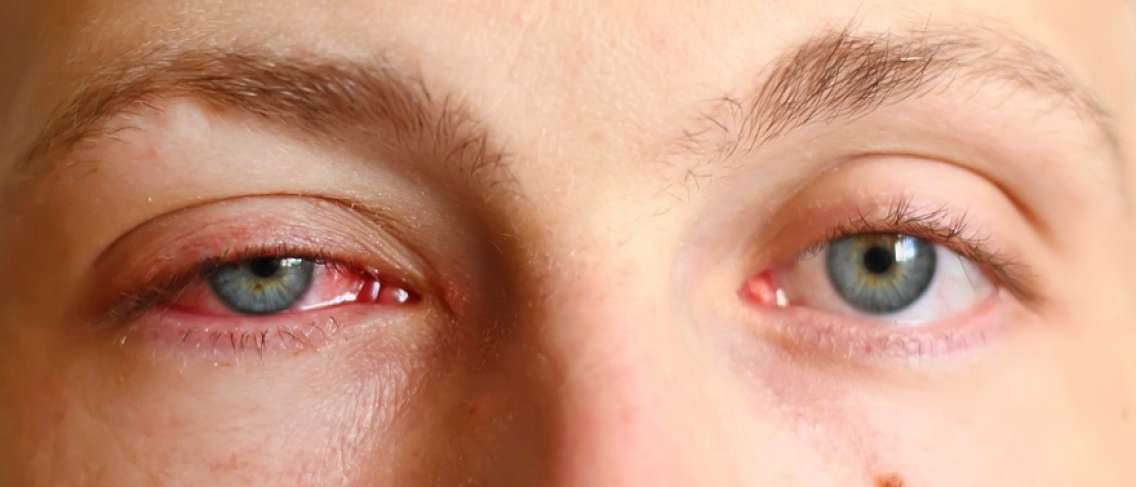 Mity i fakty powodują pęknięcie naczyń krwionośnych oka