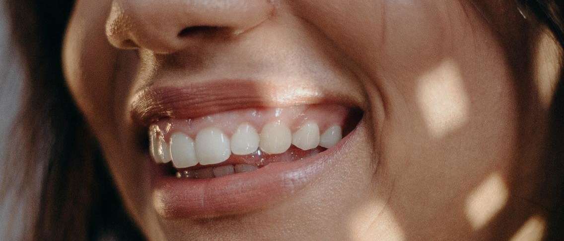 치은 절제술이란 무엇입니까?