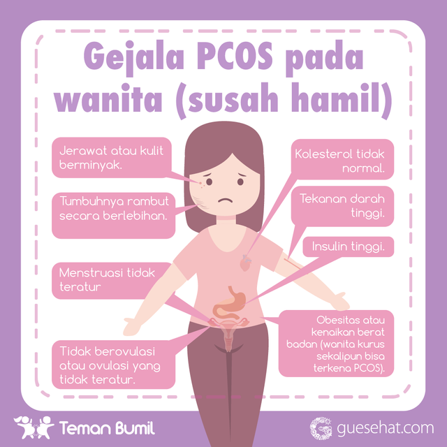 Síntomas del síndrome de ovario poliquístico en mujeres